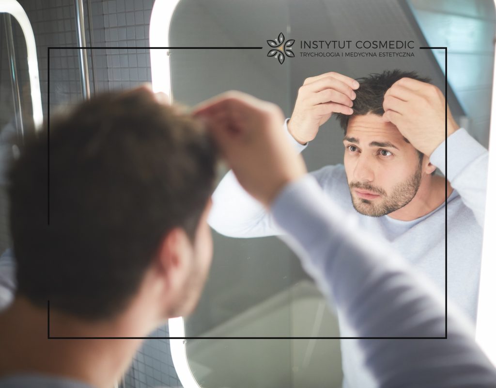 Czy stres powoduje wypadanie włosów?
