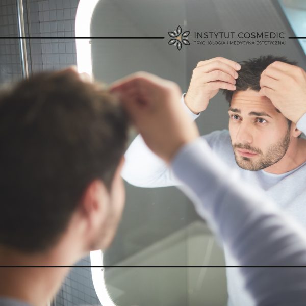 Czy stres powoduje wypadanie włosów?