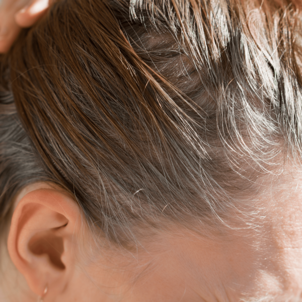 Jakie są powody siwienia włosów — dlaczego się pojawiają i w jakim wieku